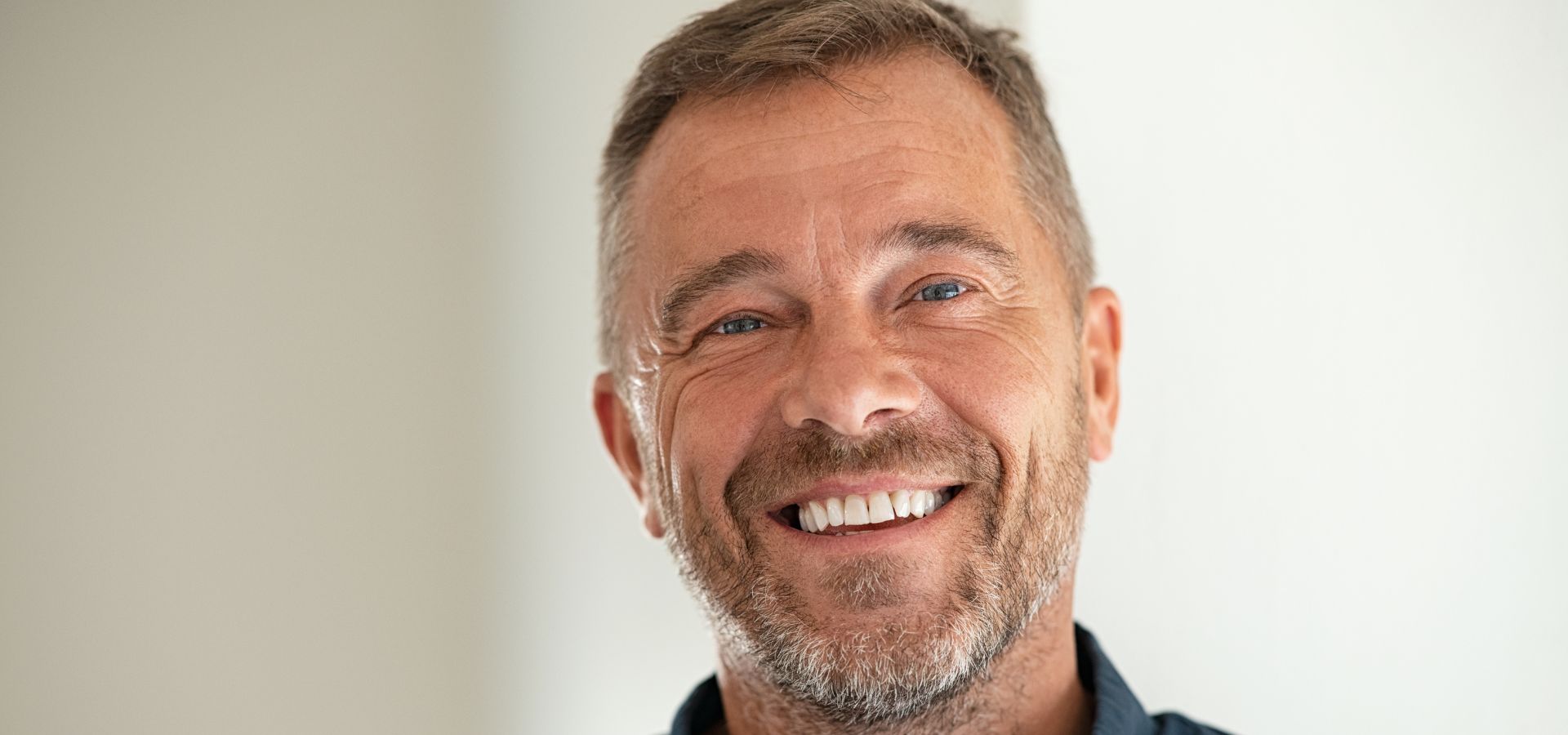 Mitos y Realidades sobre los Implantes Dentales que Debes Conocer